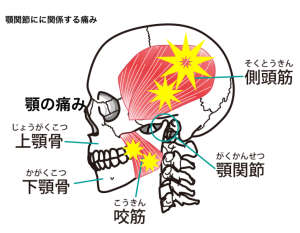 顎関節症を発生させる